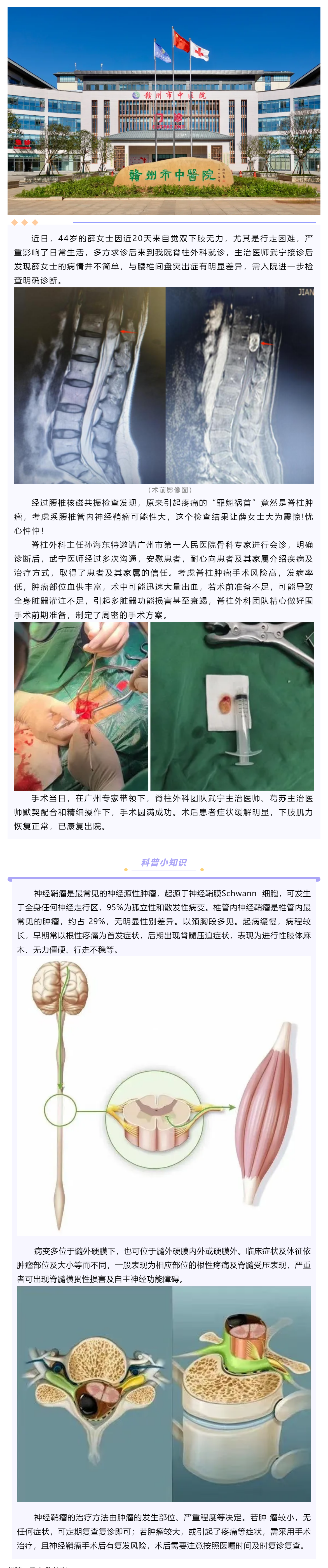 腰腿痛、下肢乏力麻木，提防神經(jīng)鞘瘤！.png